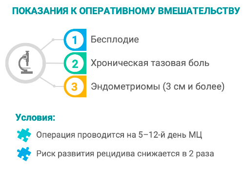 Эндометриоз: лечение, причины, признаки у женщин