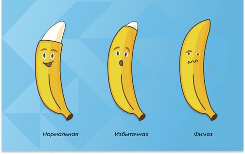 Циркумцизия