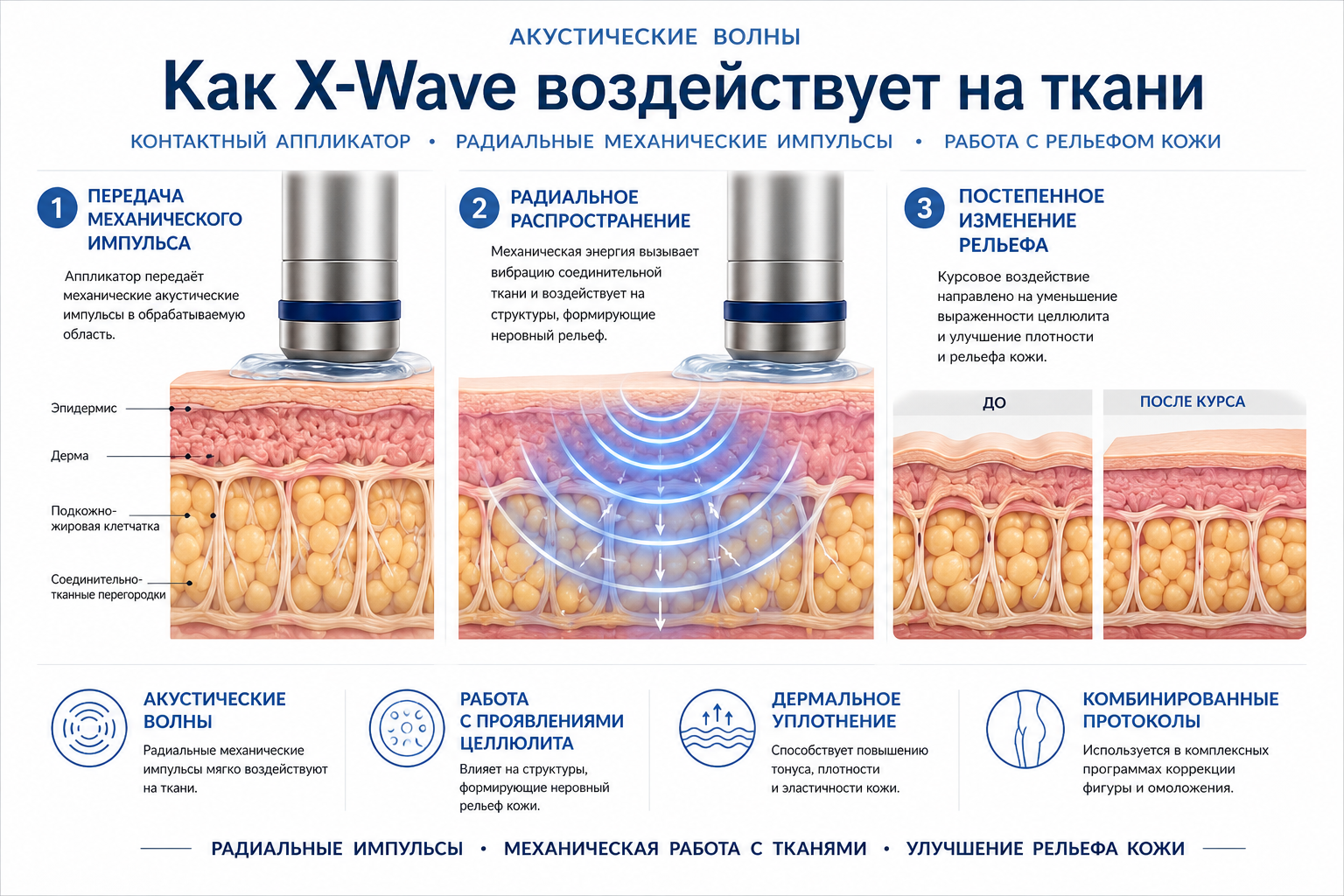 BTL X-Wave: схема радиальной акустической волны