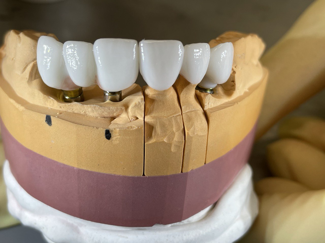 Материалы в стоматологии