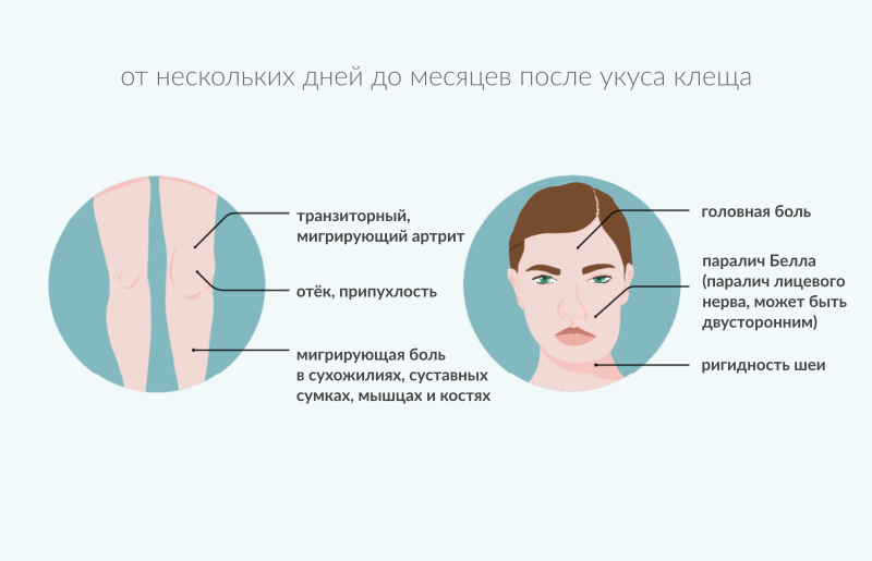 Боррелиоз карта вызова