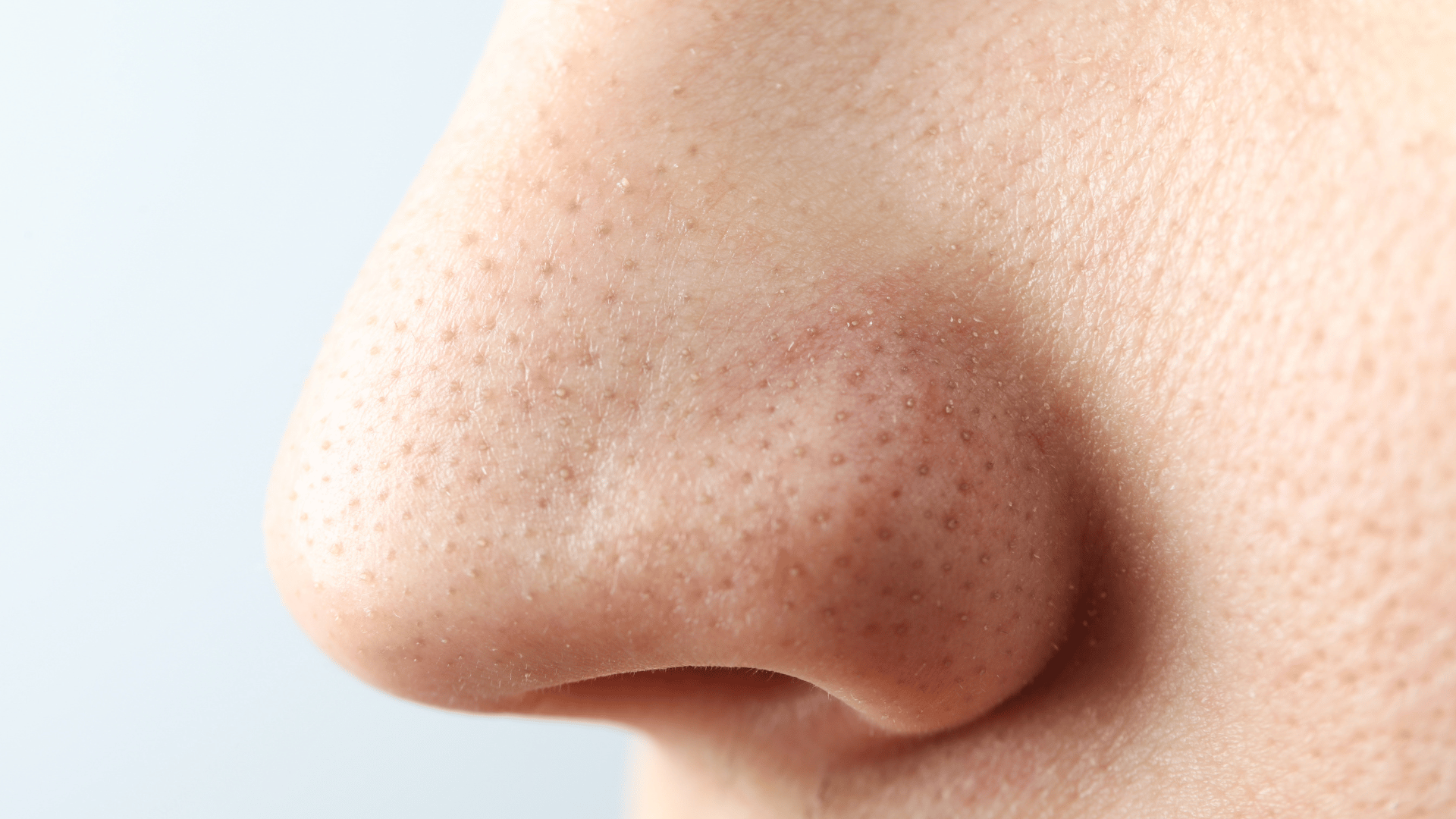 greek nose rhinoplasty
