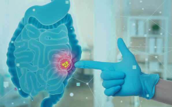 Консультация гастроэнтеролога и обследование желудка в СПб | Пройдите ...