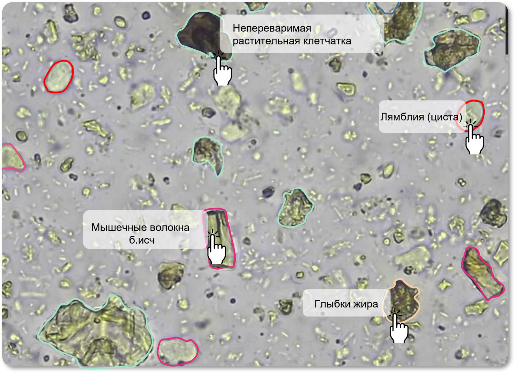 Обнаружение цисты лямблий в нативном препарате кала на снимке со станции Sciendox 2000R