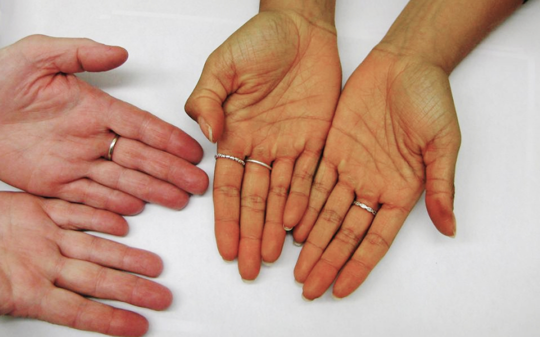 proyavlenie-anemii-na-kozhe