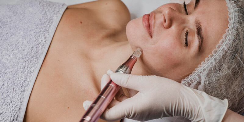 Фракционная мезотерапия лица: принцип работы, показания и результаты