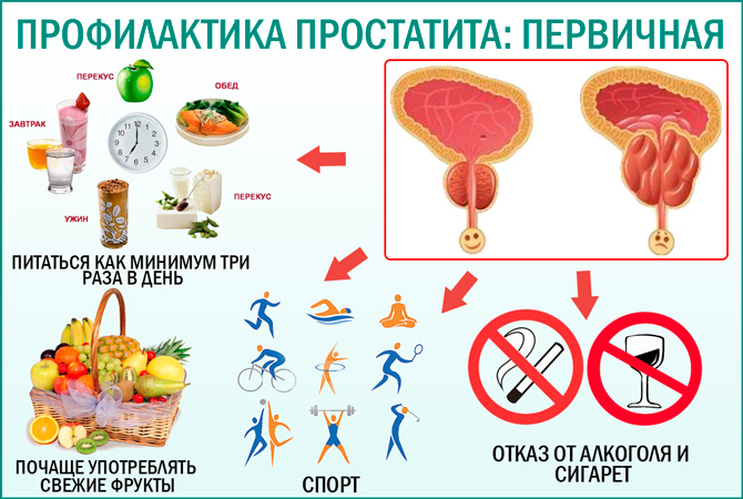 Какой Секс При Простатите