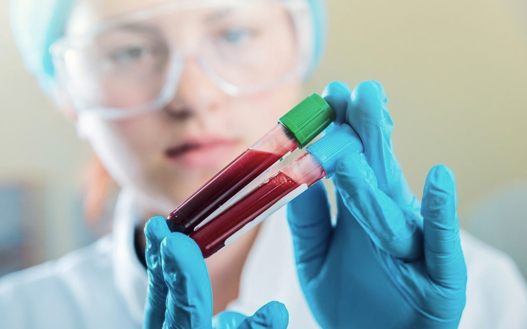 laboratornaya-diagnostika-anemii