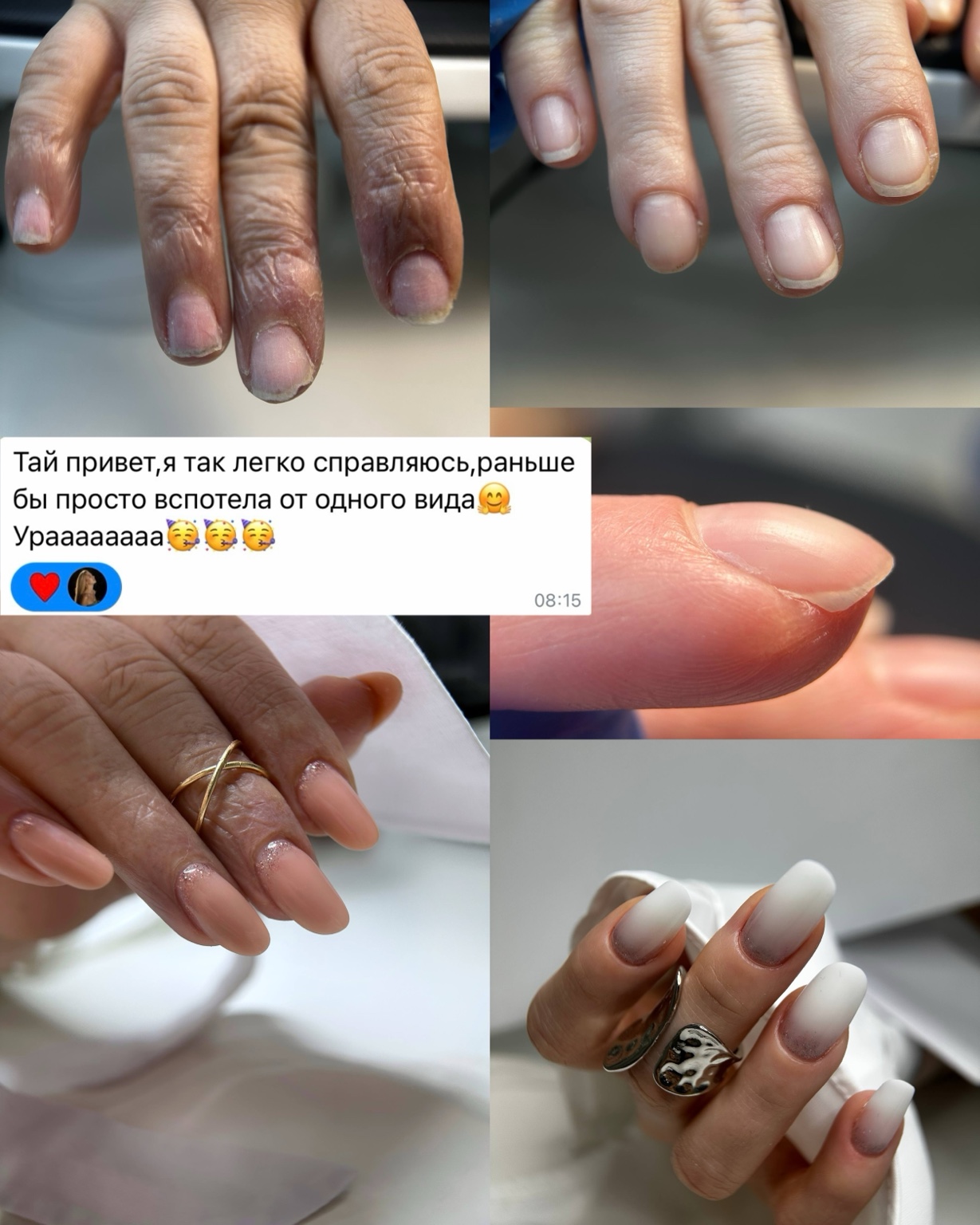 Коллаж до и после обучения SMART FORM