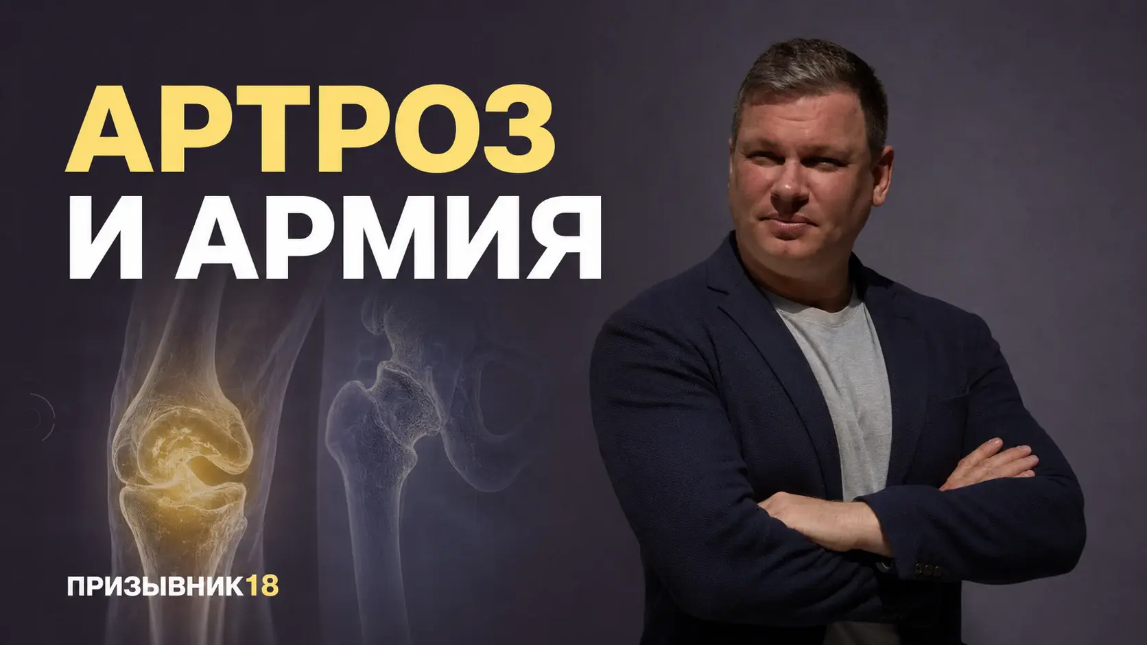 Артроз и армия