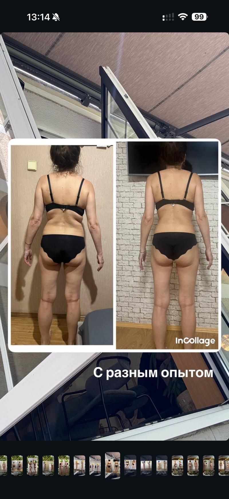 До и после ХМРЗ