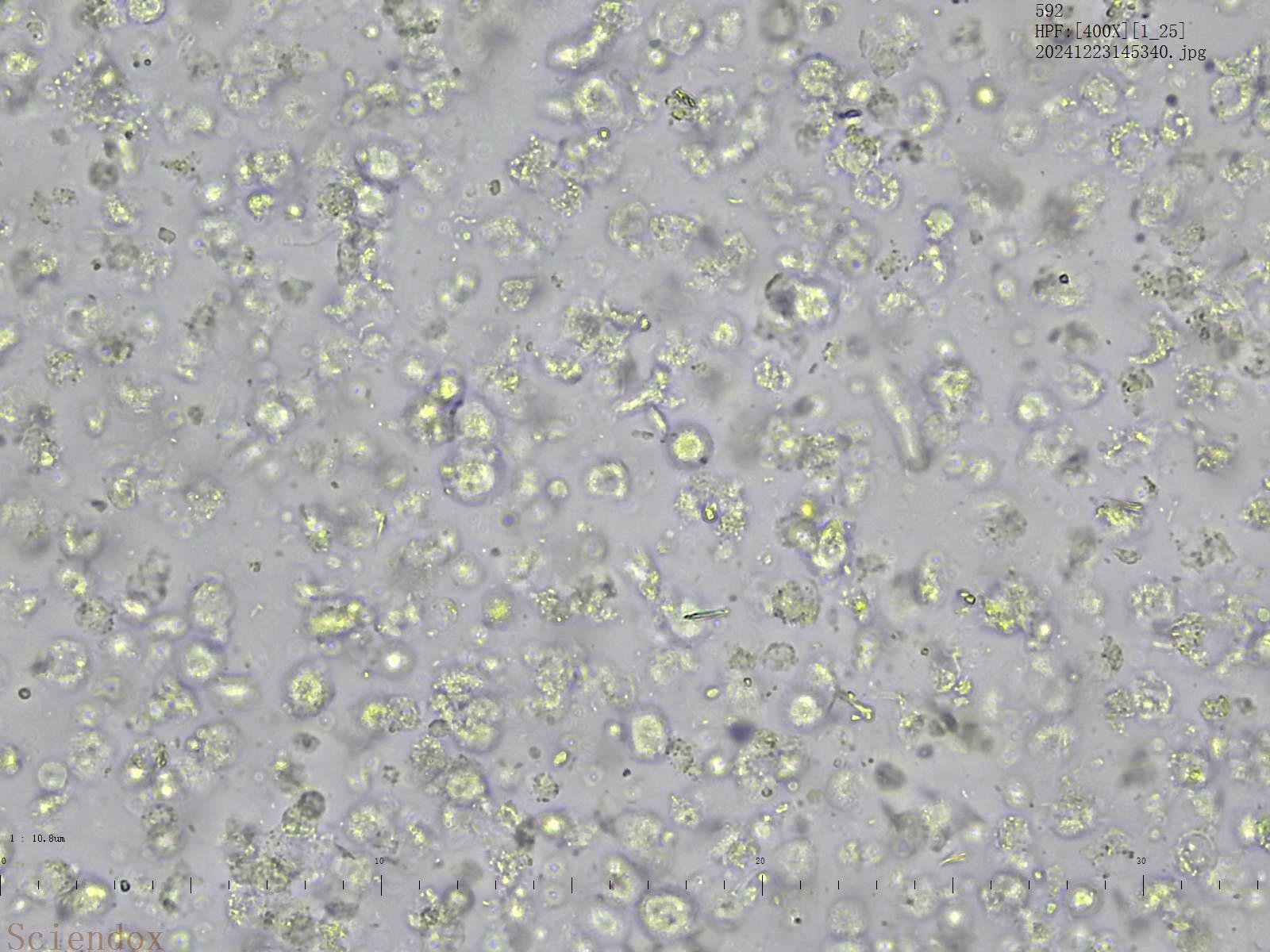 Снимок нативного препарата кала со станции Sciendox 2000R