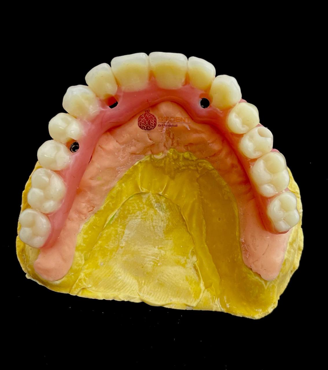 S.T.DENT — Изготовление всех видов зуботехнических конструкций для  стоматологических клиник