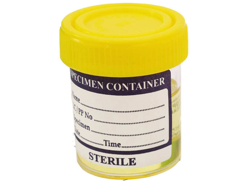 Руководство по расшифровке анализов