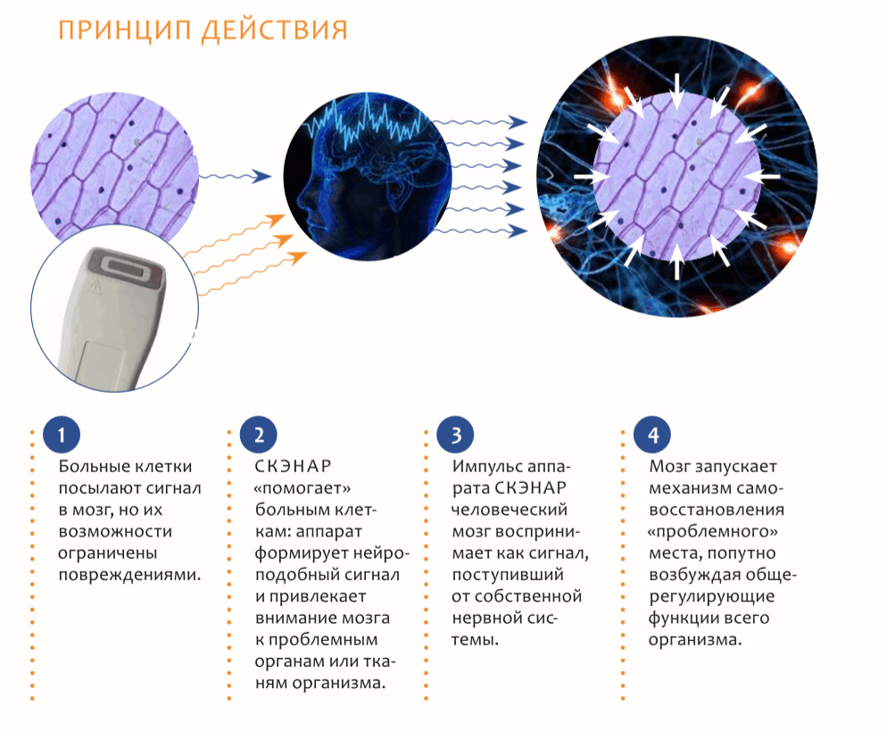 СКЭНАР – физиотерапевтический аппарат чрескожной электронейростимуляции