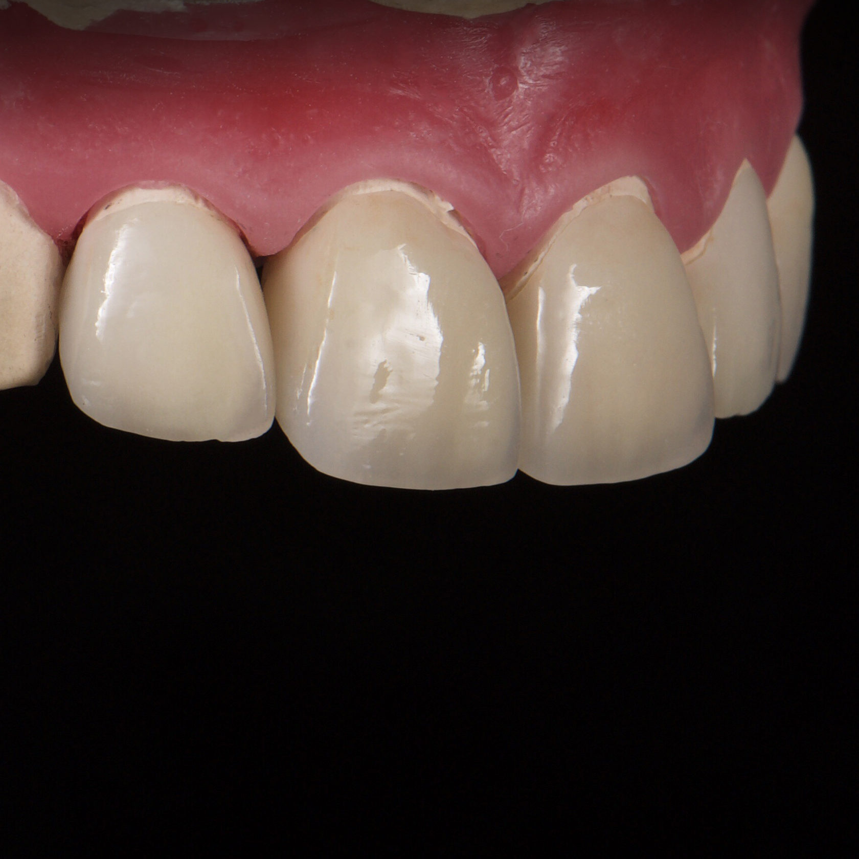 Зуботехническая лабораториия прайс