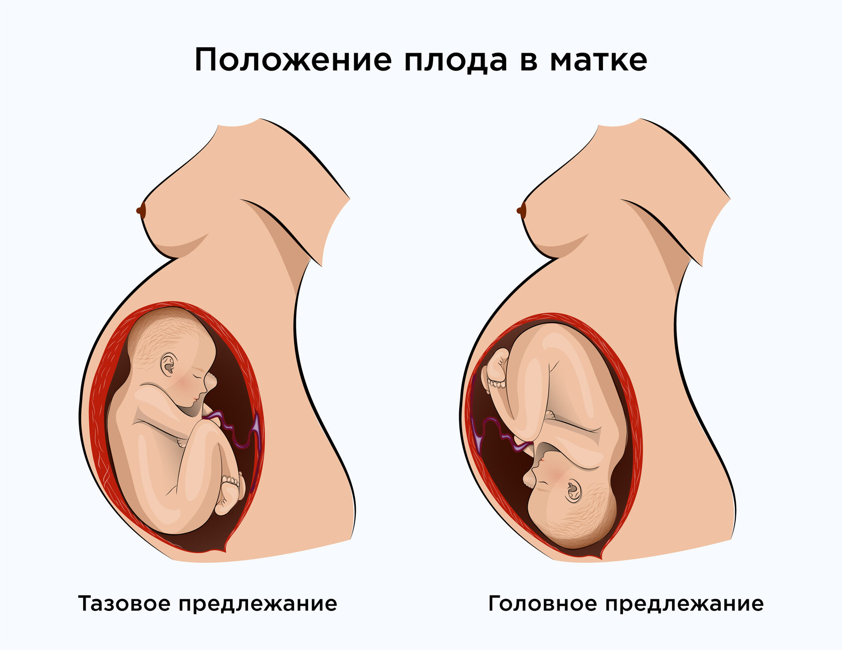Чем опасны роды в 8 месяцев беременности?
