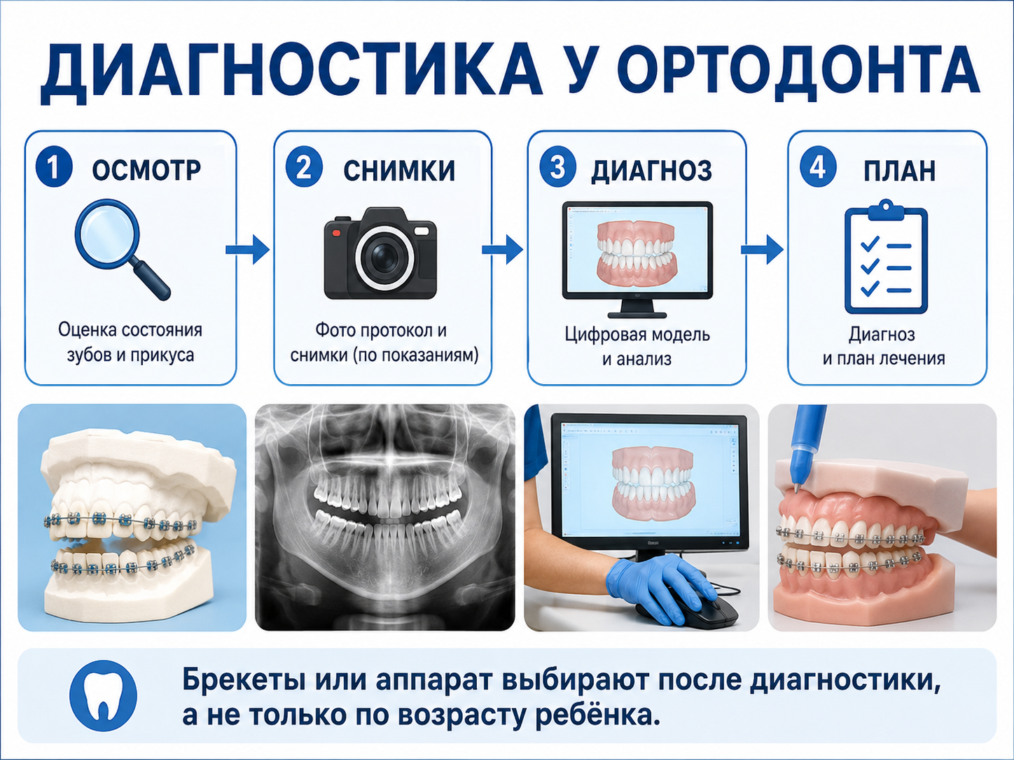 диагностика прикуса у детей перед ортодонтическим лечением