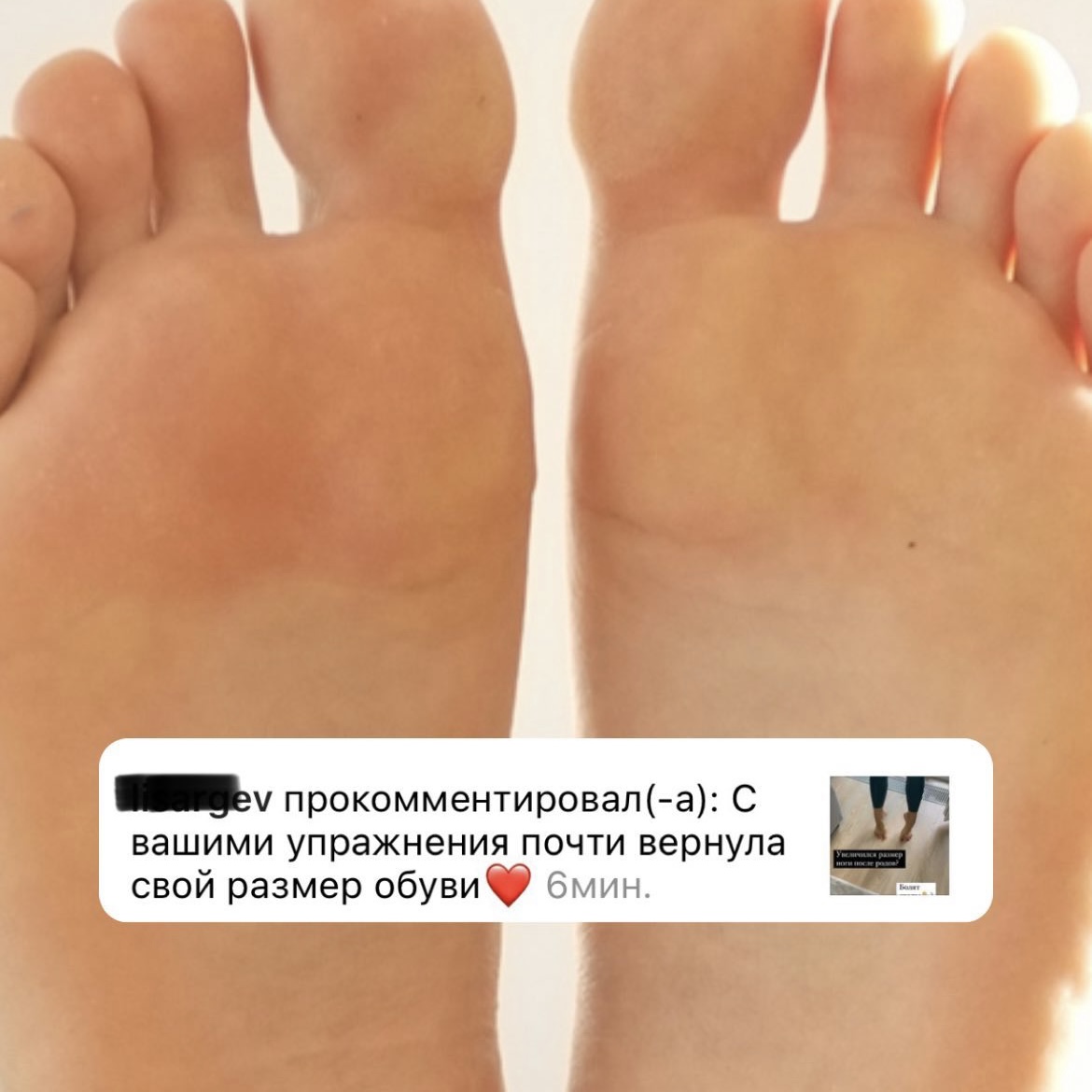 Здоровая стопа 30 й микрорайон 7 фото