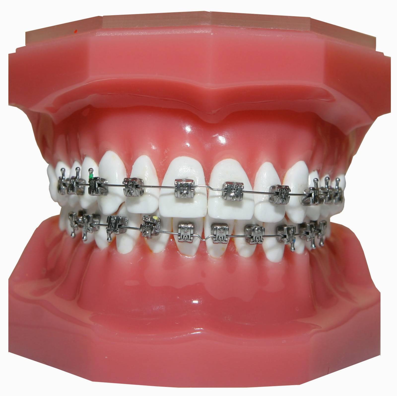 Deroode orthodontics