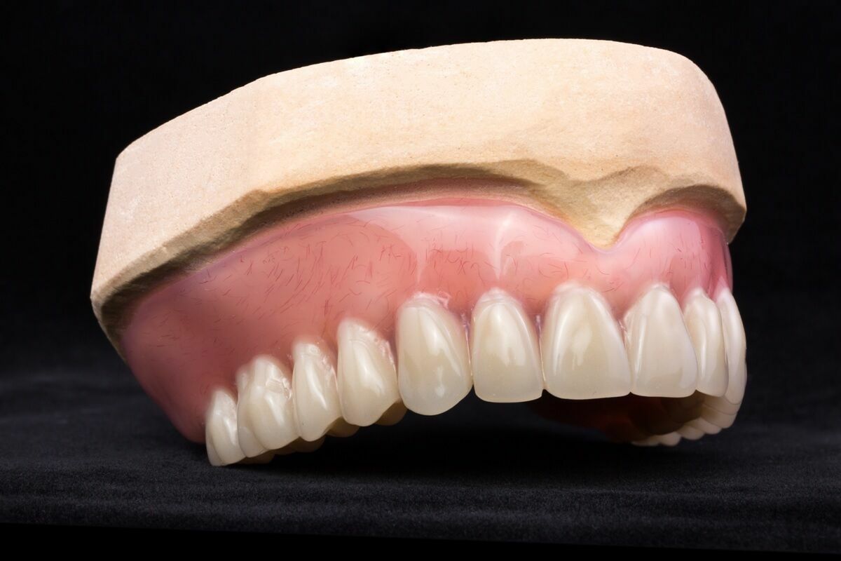 Протез на челюсть без зубов. Полный съемный протез IVOCAP. Полносъемные протезы ортопедическая стоматология. Полный съемный протез на верхнюю челюсть. Зубной протез на верхнюю челюсть.