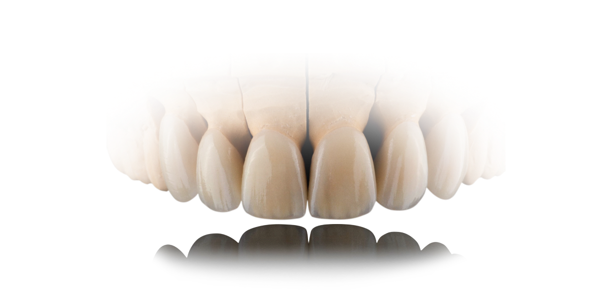 Зуботехническая лаборатория в Липецке | New-Dent
