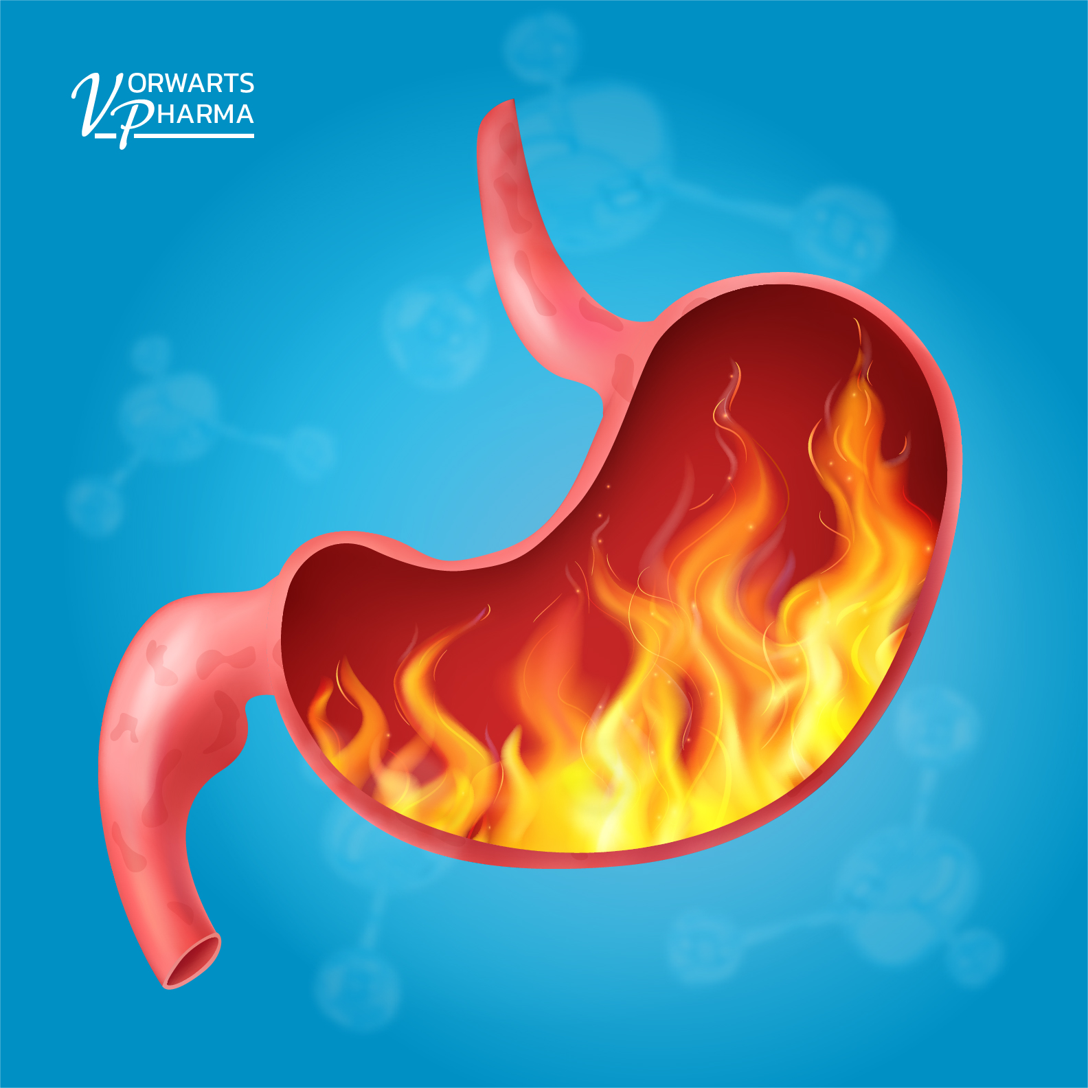 All about heartburn. Causes, symptoms and effective ways to help