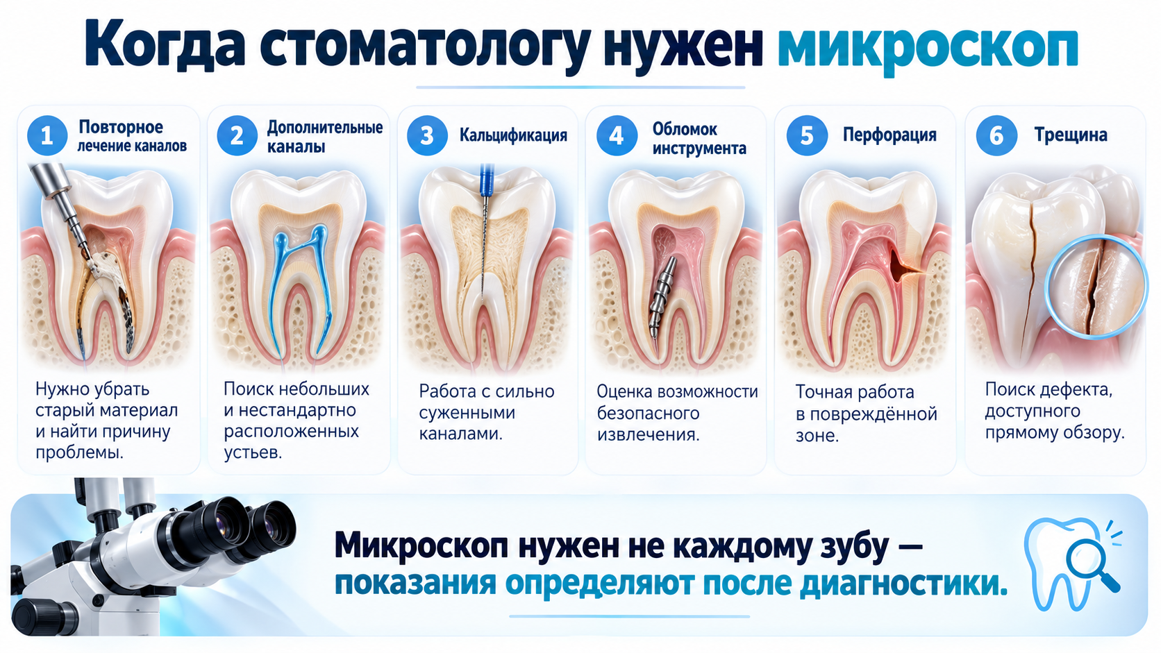 Этапы лечения корневых каналов под микроскопом
