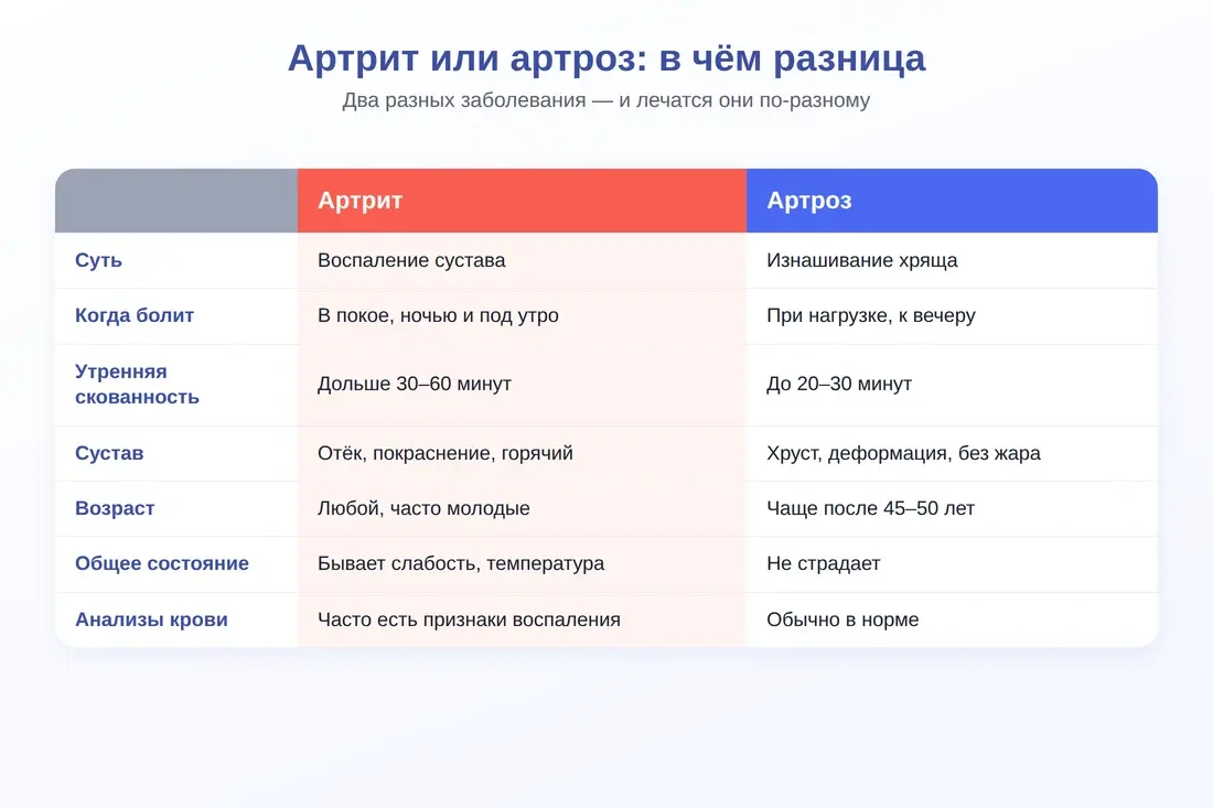 Сравнение артрита и артроза: характер боли, скованность, отёк
