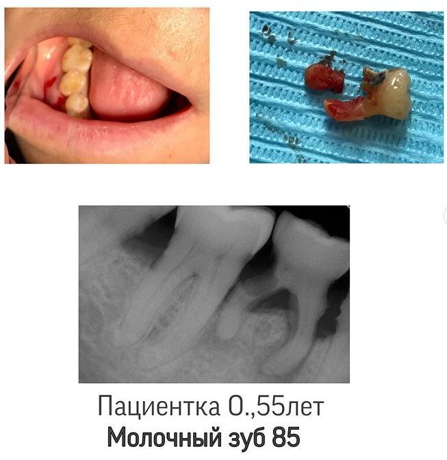 Помощь стоматолога