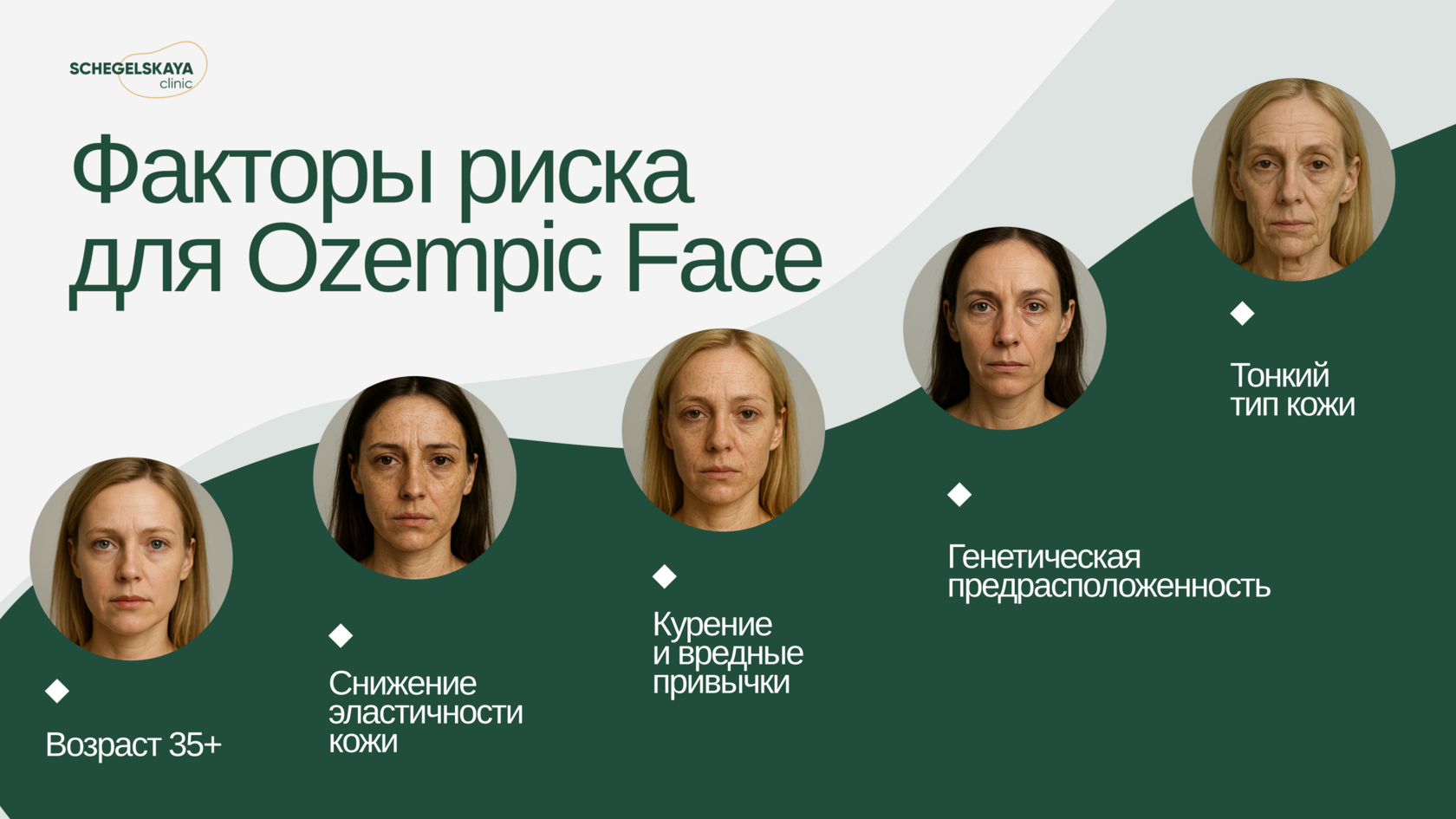 Инфографика: факторы риска Ozempic Face — 35+, низкая эластичность кожи, курение, генетика, тонкая кожа.