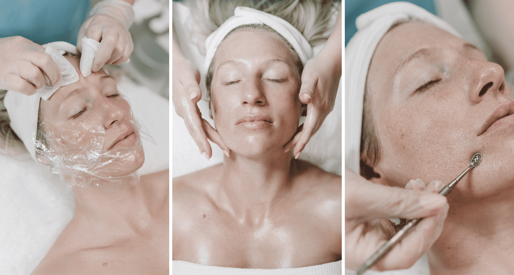 Acne treatments at Beauty Studio by Hanna in Mount Pleasant, SC