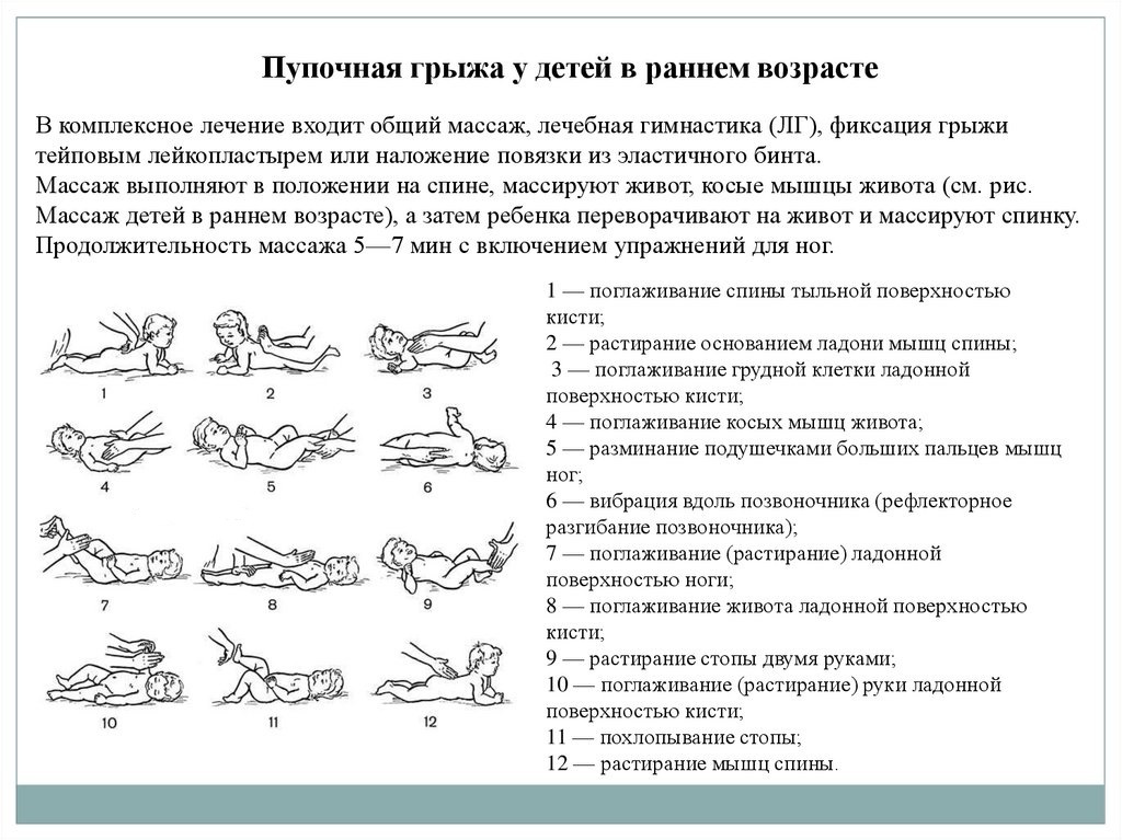 Пупочная грыжа: причины, симптомы, чем опасна, как лечить | Блог хирургической клиники Garvis