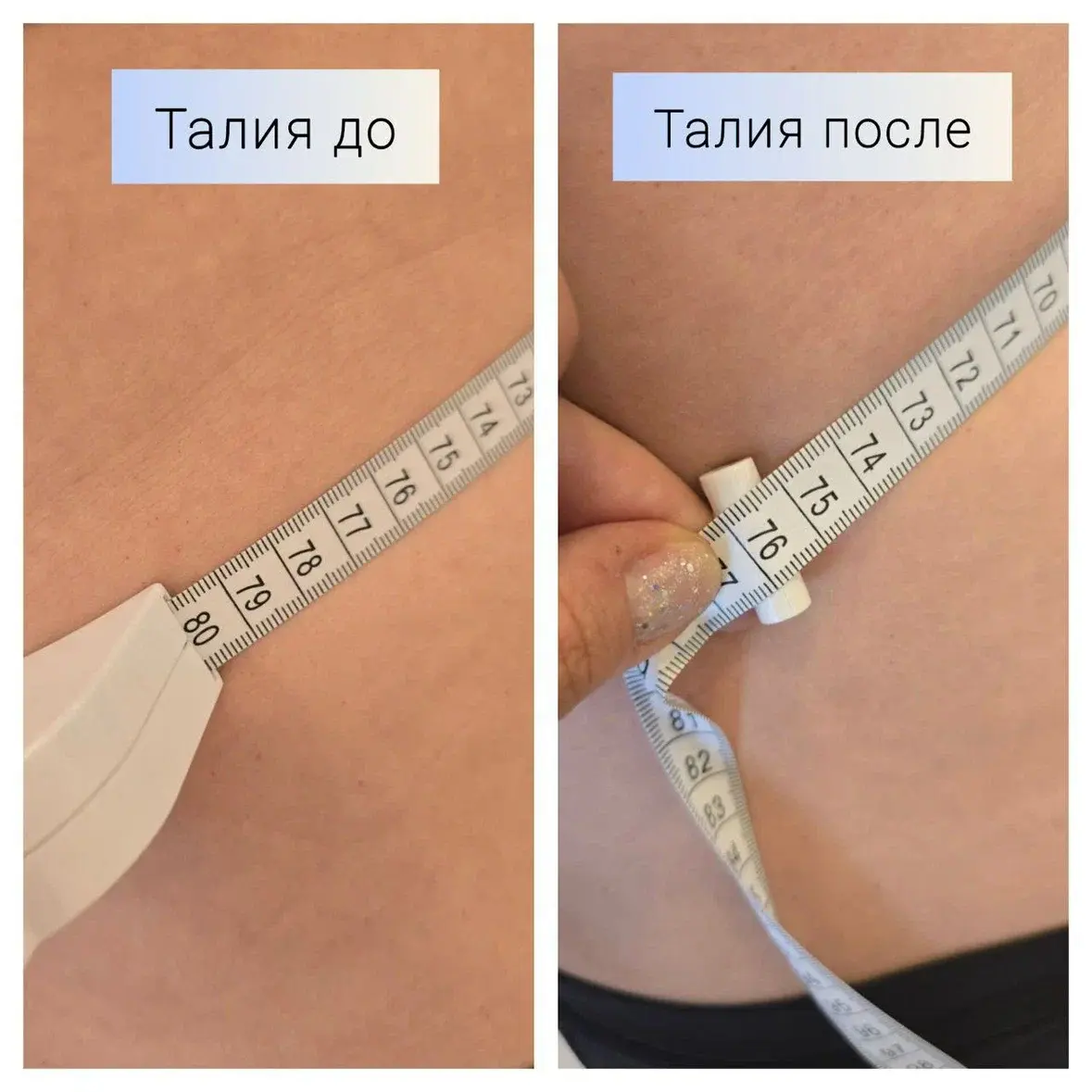 Замеры талии до/после