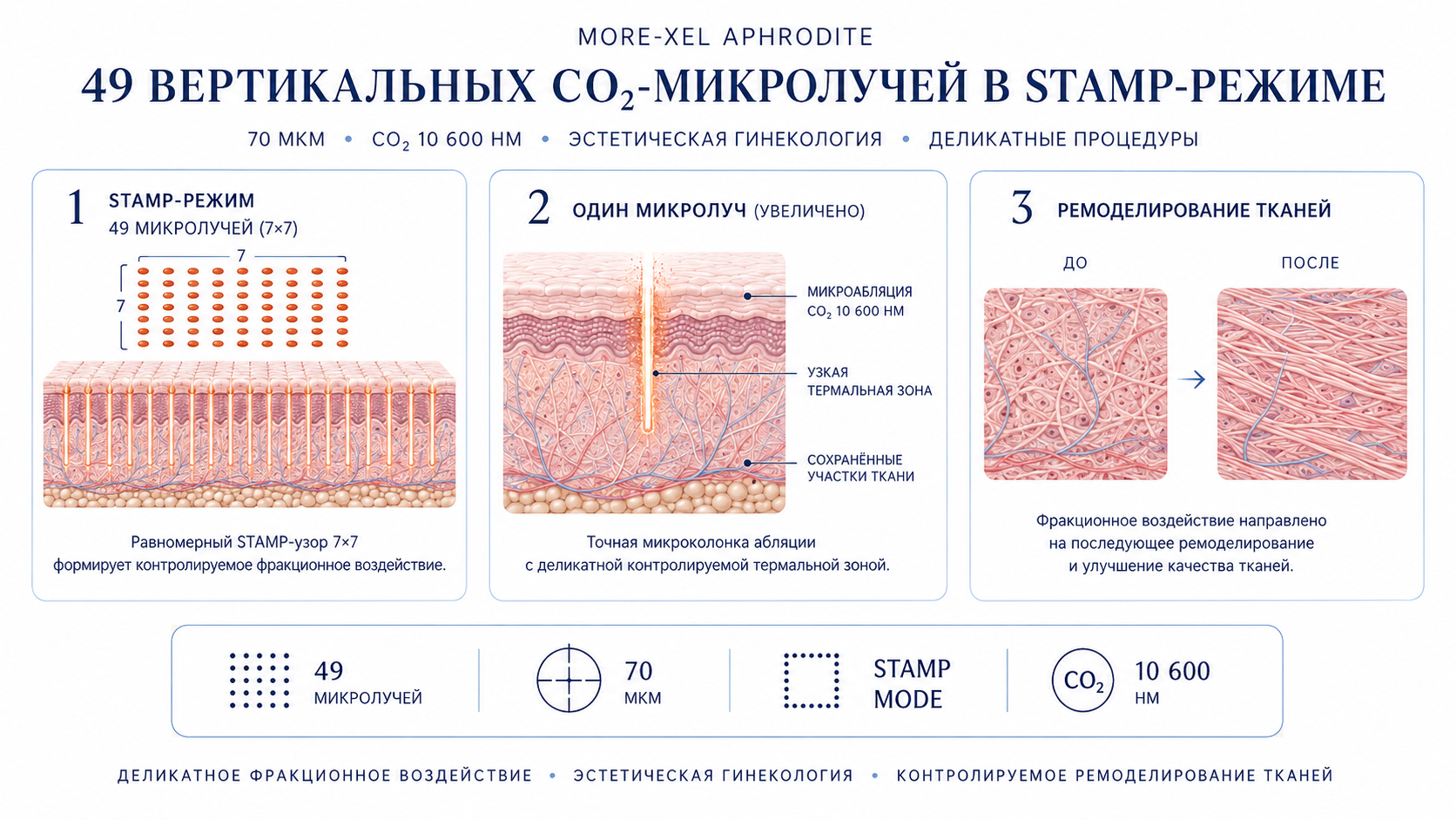 Увеличенная схема More-Xel Aphrodite STAMP