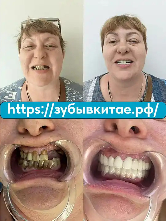 До и после — кейс 15