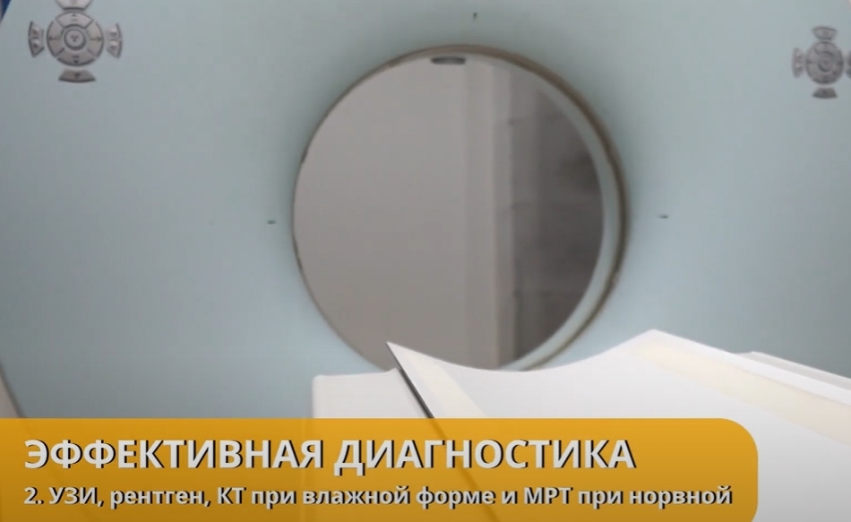 Компьютерная томография при FIP КТ диагностика при FIP