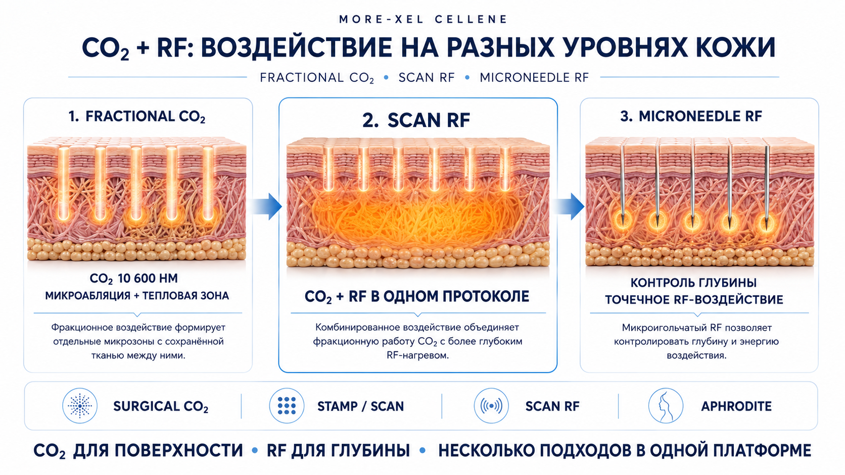 More-Xel Cellene: CO2, Scan RF и микроигольчатый RF
