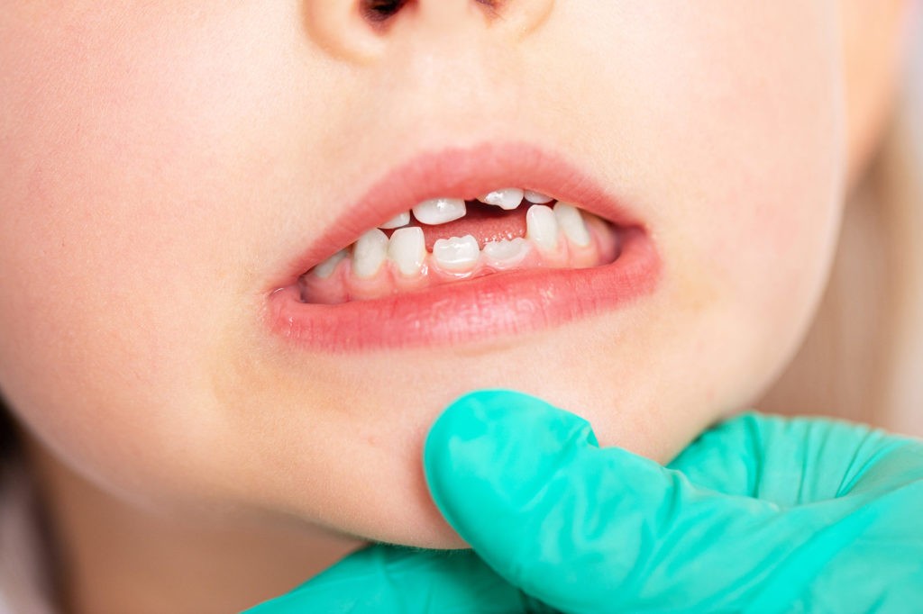 Когда у детей появляются первые зубы?