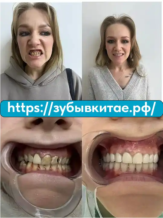 До и после — кейс 8