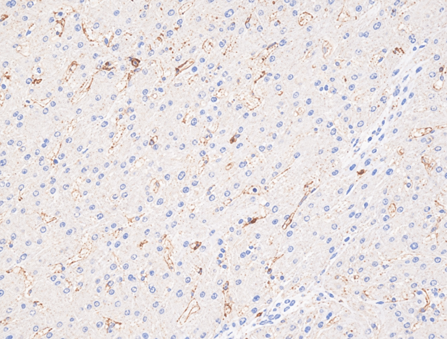Недостаточное окрашивание CD4 в печени
