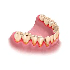 имплантация зубов, имплантация зубов Голицыно, стоматология в Голицыно, имплантация зубов цена, имплантация зубов под ключ, имплантация зубов под ключ цена, имплантация зубов МСК, имплантация Москва, зубной имплант Голицыно, установка импланта, зубное протезирование.