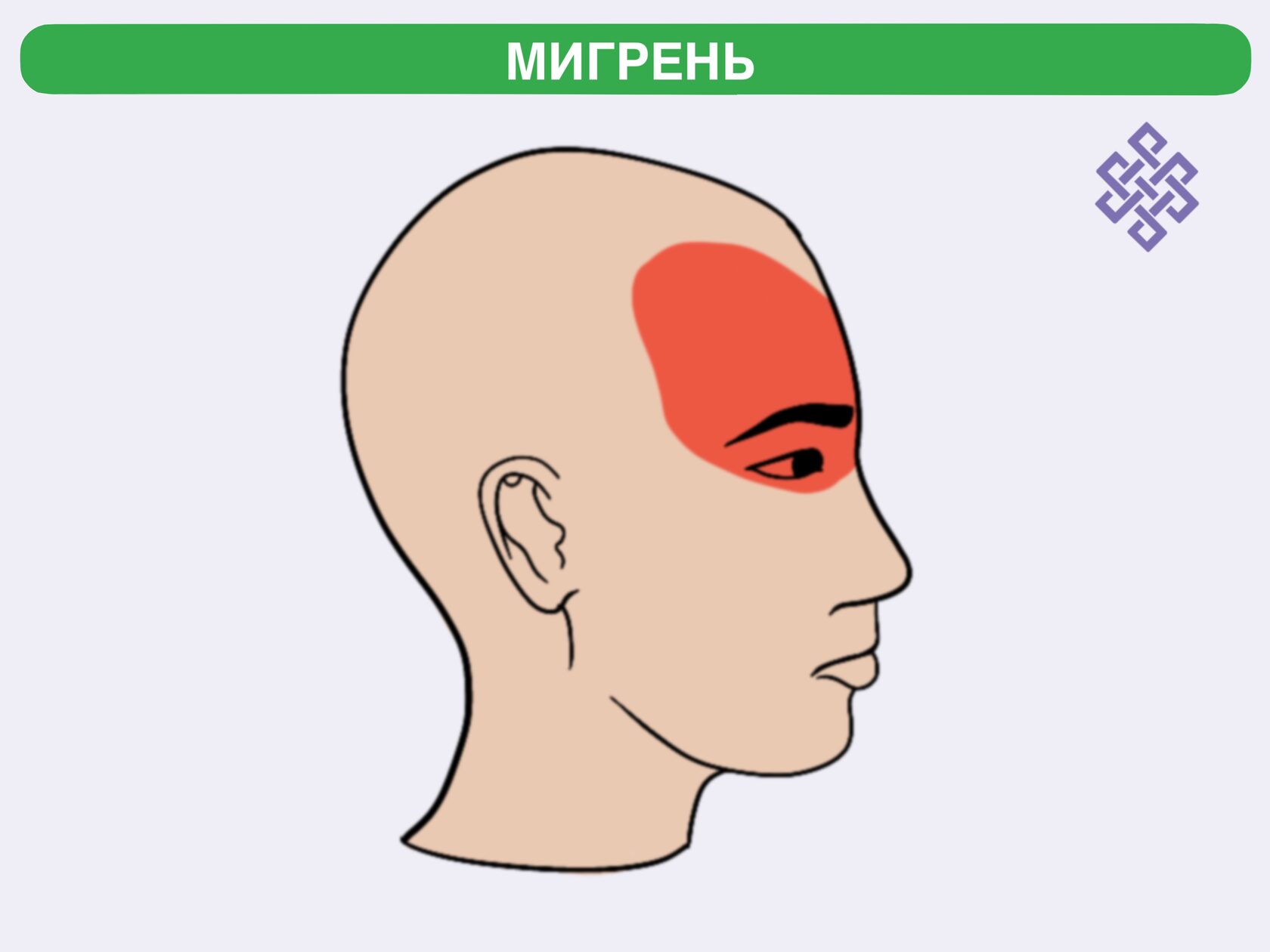 Боль при повороте головы