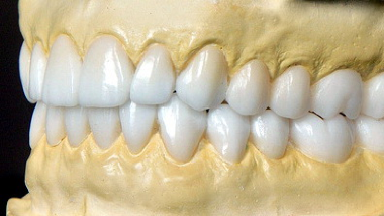 Восковое моделирование улыбки — цены в Дербенте. Стоматология DK