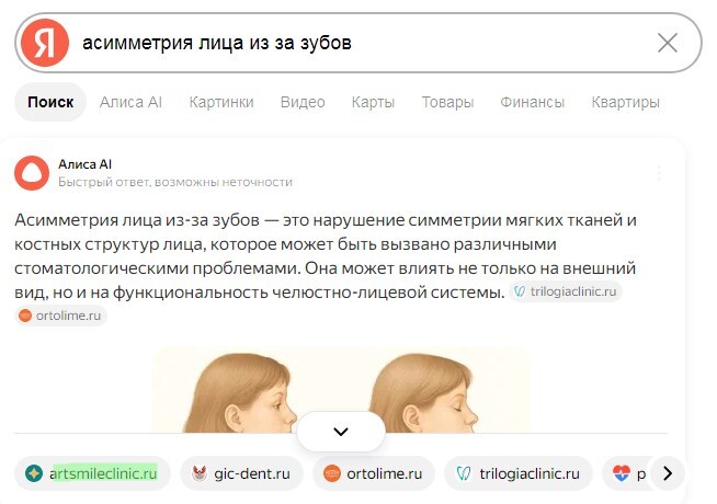 Ответ Алисы AI по запросу «асимметрия лица из-за зубов»