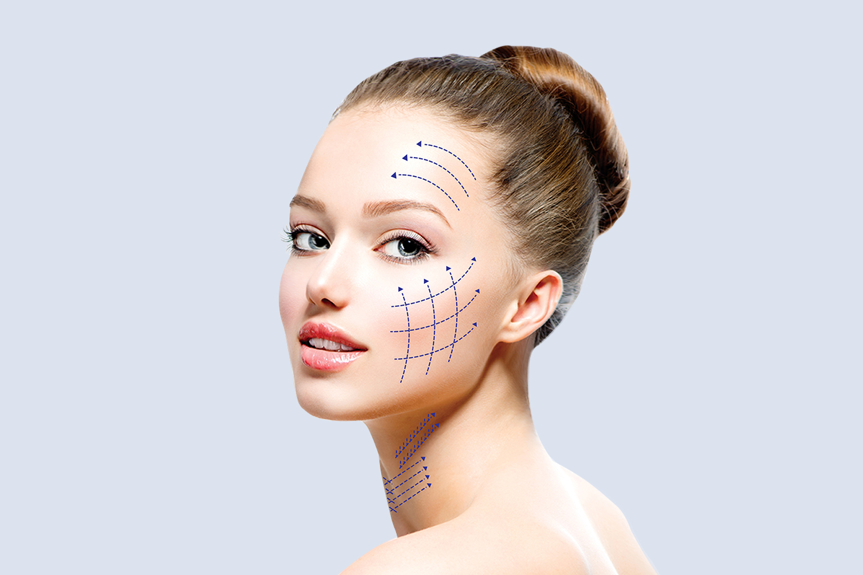 Микроигольчатый RF-лифтинг