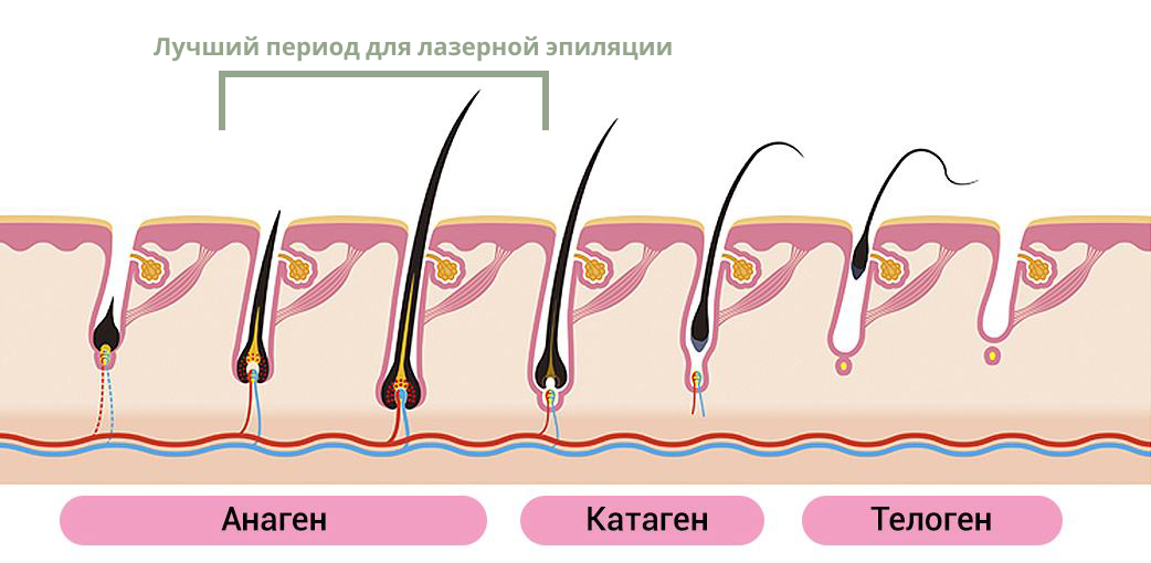 Как и когда выпадают волосы после лазерной эпиляции