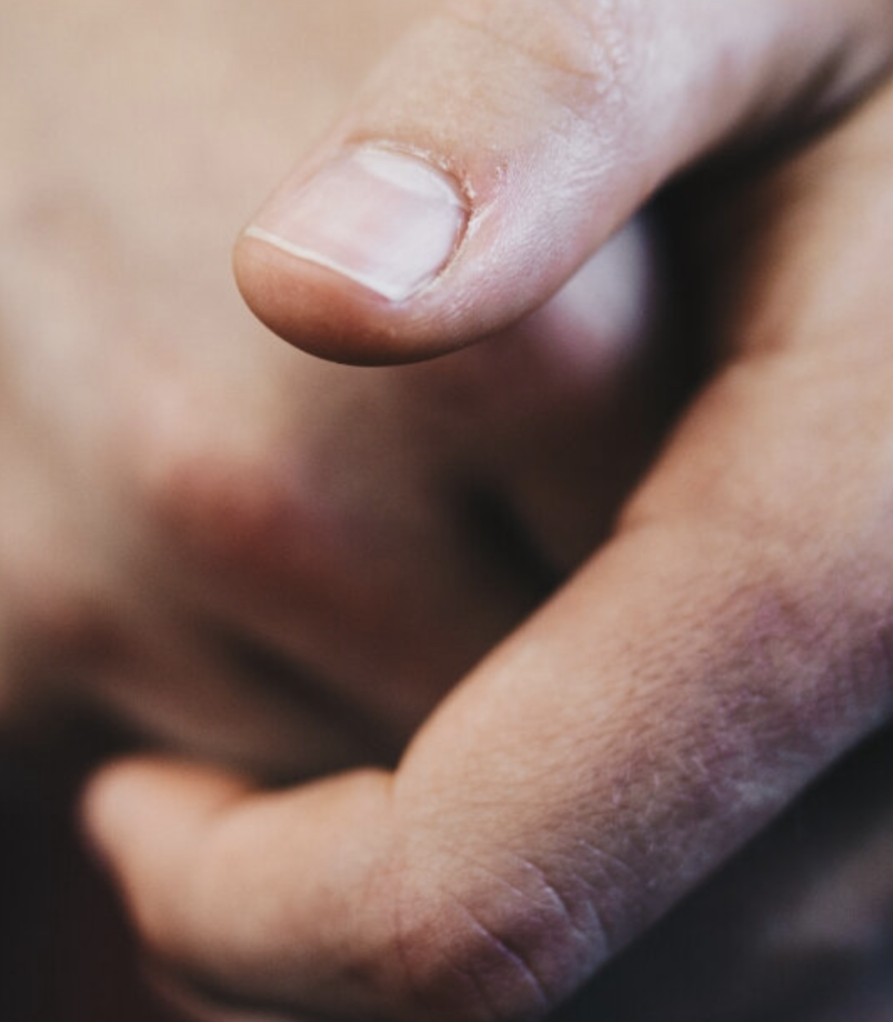 Здоровая кожа вокруг ногтей - что делать, чтобы избежать заусенцев?