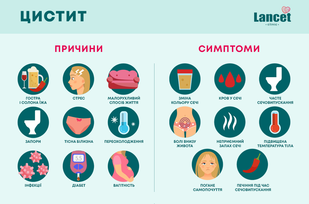 Цистит: причини та симптоми