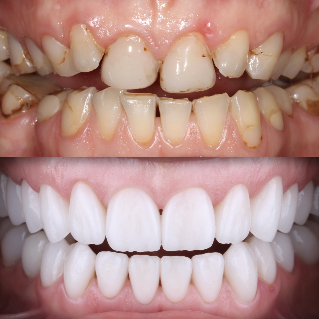 Санация полости рта: процедура, формы и справка